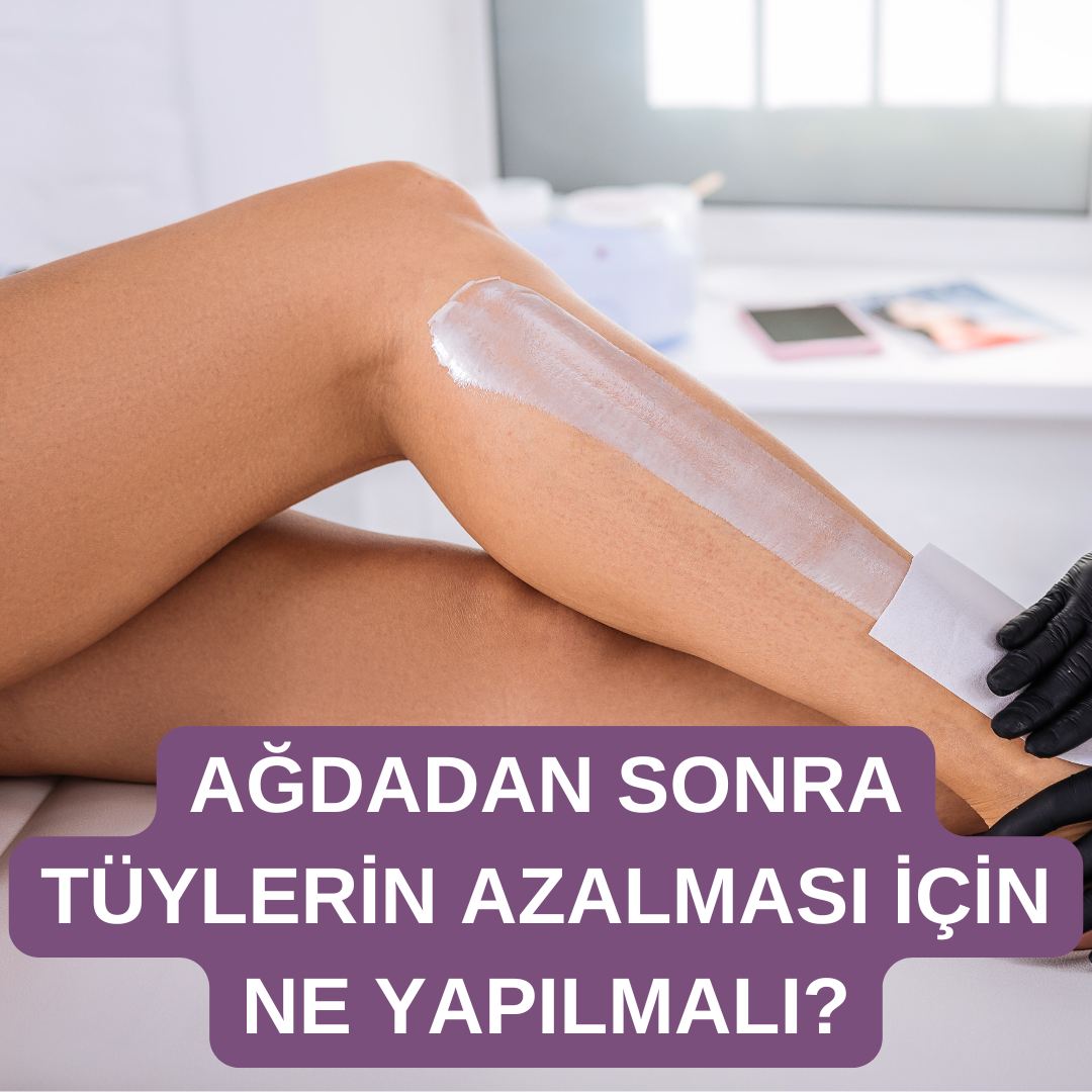 Ağdadan Sonra Tüylerin Azalması İçin Ne Yapılmalı?