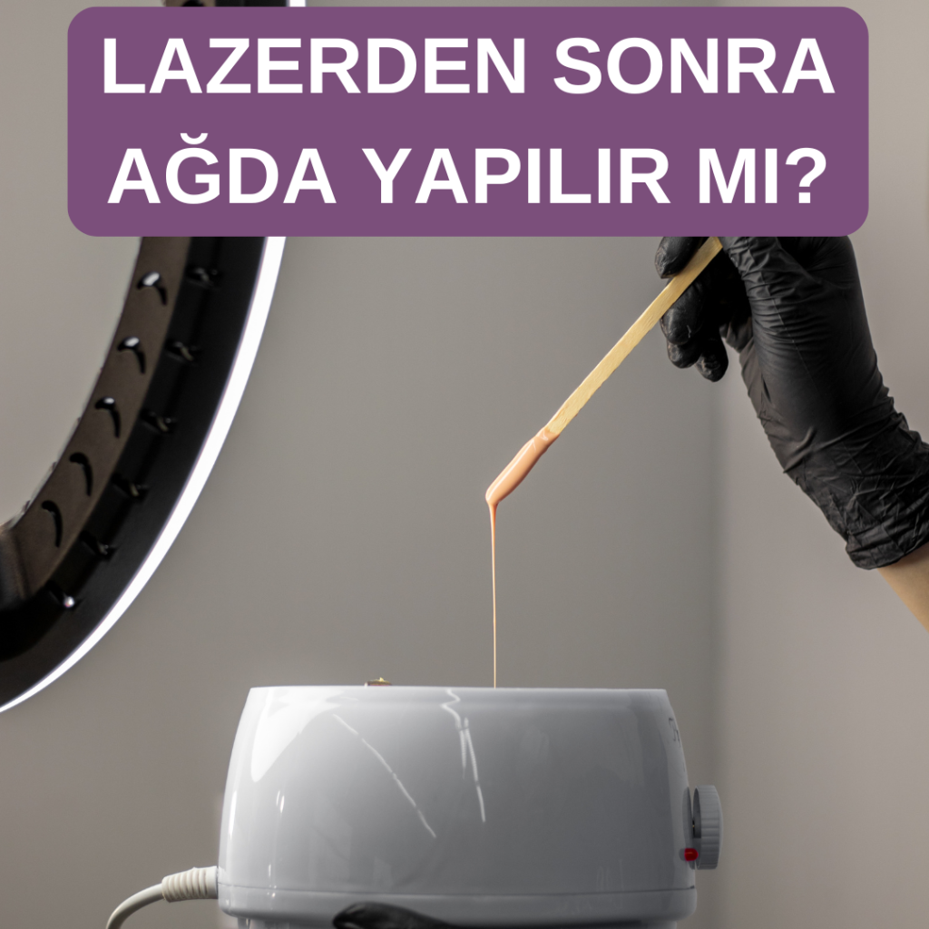 lazerden sonra ağda